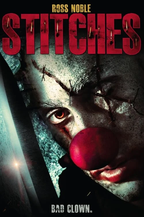 Stitches