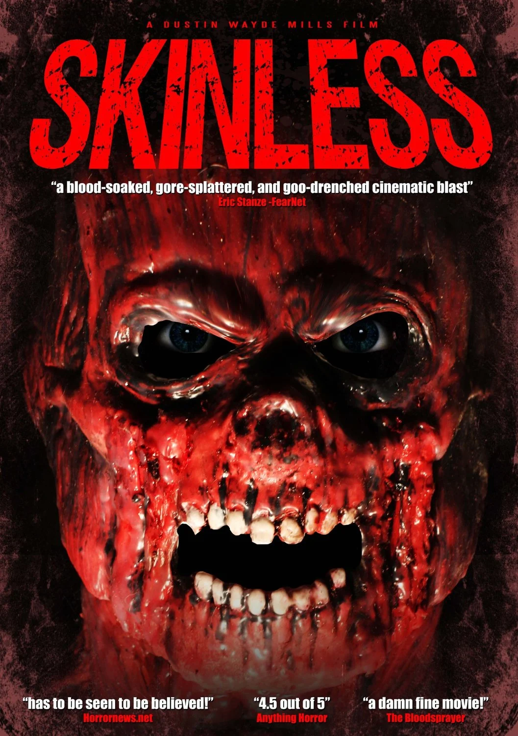 The Ballad of Skinless Pete